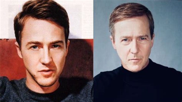 Edward Norton&rsquo;s Plastic Surgery Did the Glass Onion Star Have Facelift