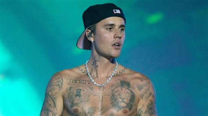 Is Justin Bieber's Ramsay Hunt Syndrome Contagious? Music Times