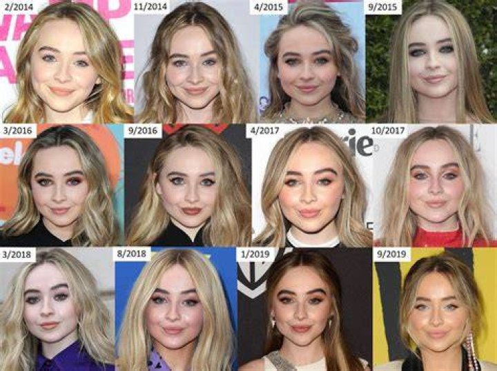 Sabrina Carpenter Plastic Surgery Botox And Lip Filler